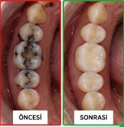 Bahar Diş Kliniği Görsel 3