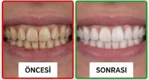 Bahar Diş Kliniği Görsel 6